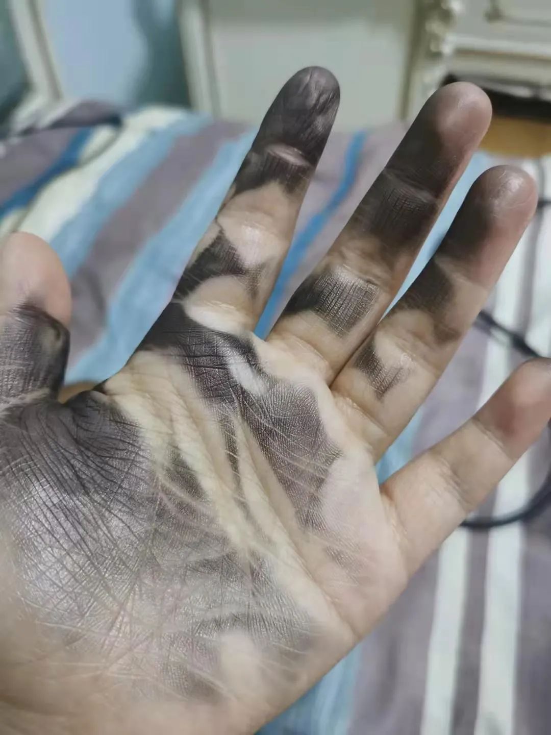 电热水袋出事,电热水袋破了有危害么