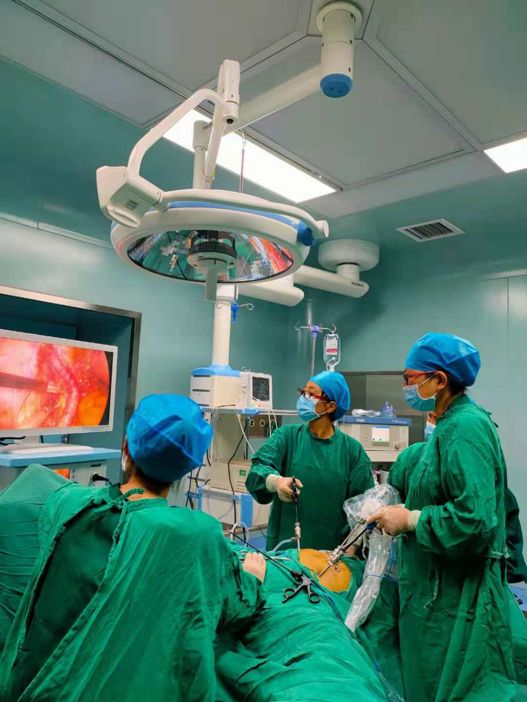 富源县医院能做腹腔镜手术吗,宫颈癌早期做了腹腔镜下根治手术