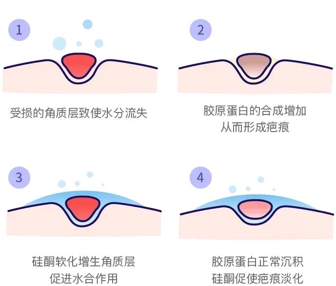有效淡化疤痕的六个小妙招,贴上疤痕贴也长疤痕