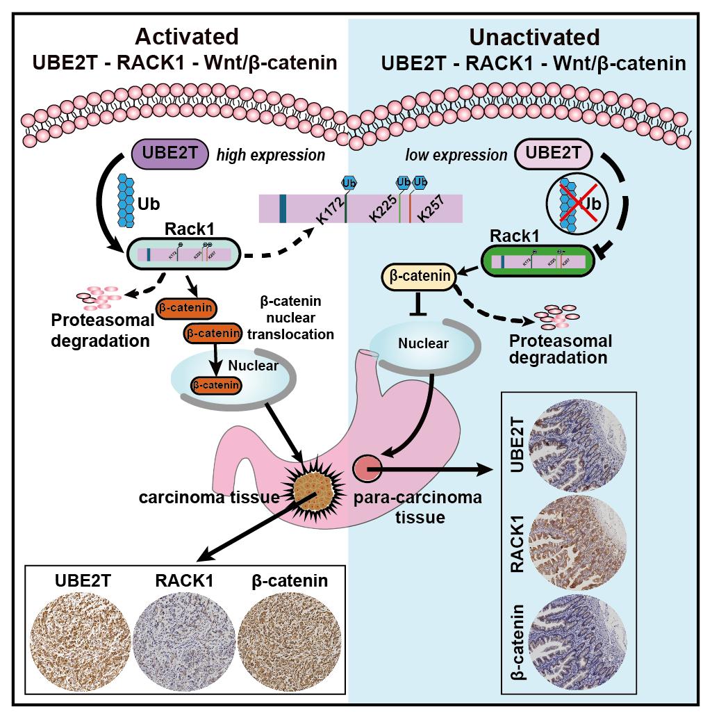 兰大二院焦作义大夫简介,兰大二院肿瘤介入治疗
