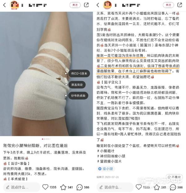 整容整腰,整容整的满脸高科技却一点不高级