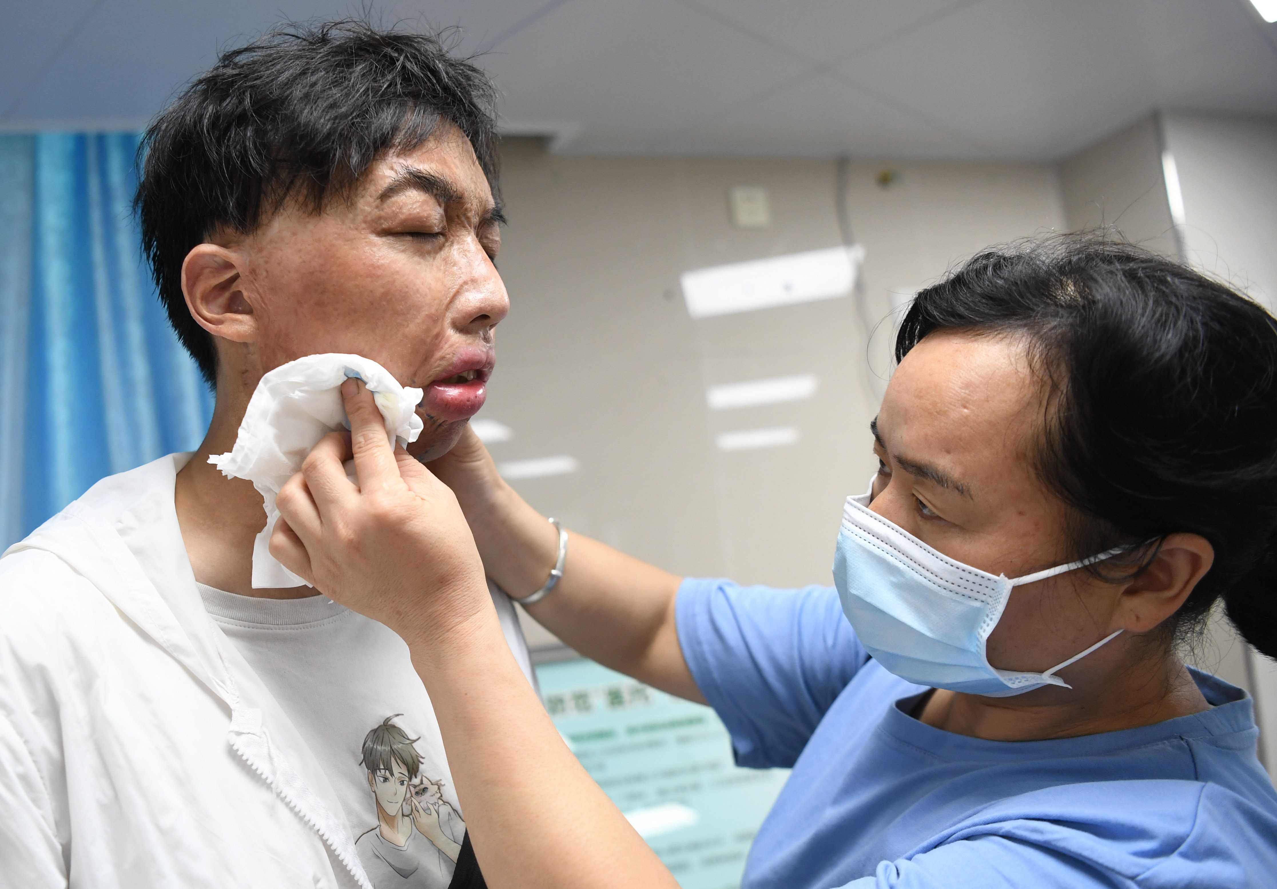 面具男孩,面具男孩治好了吗