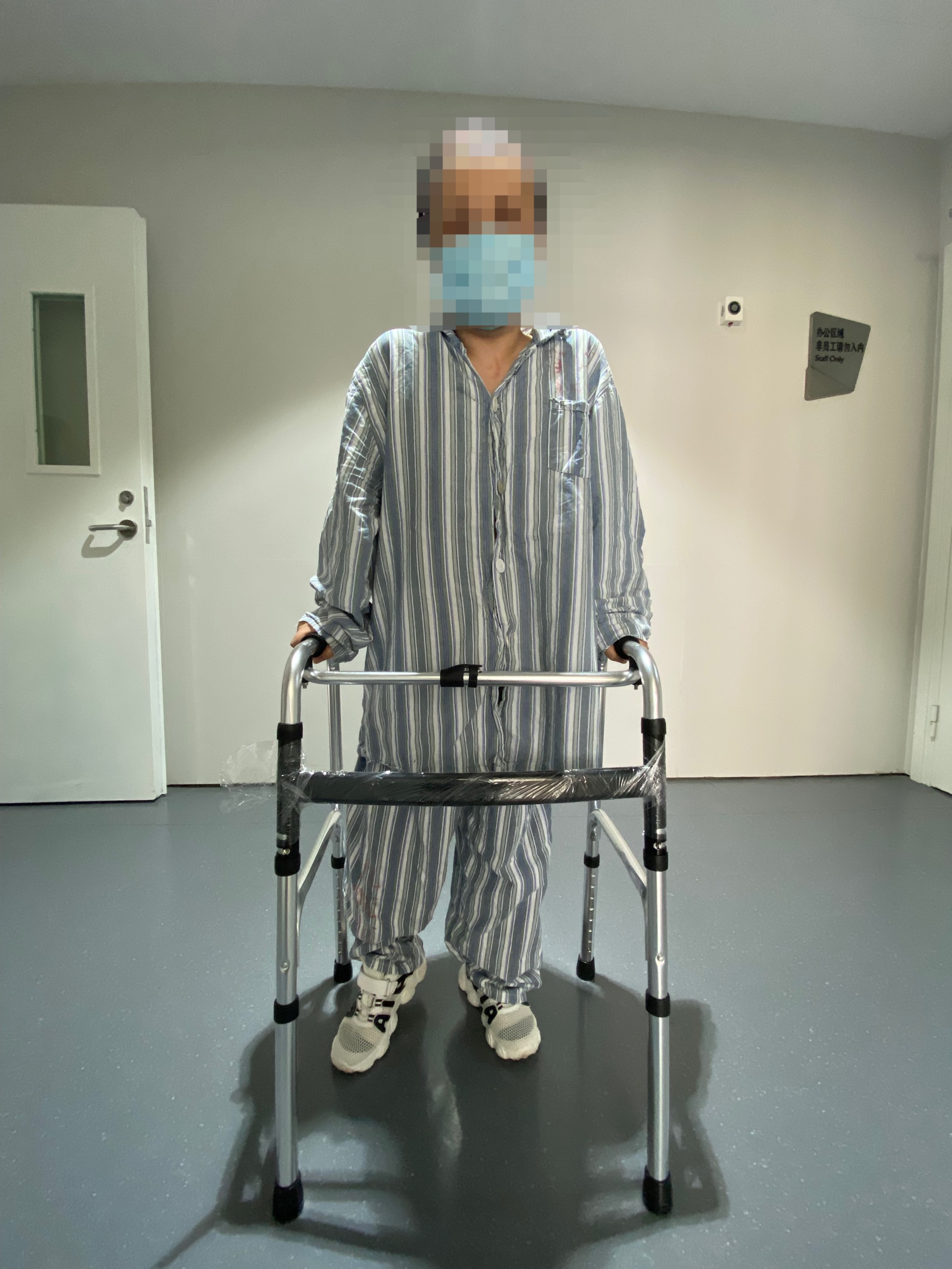 最先进三维打印钛骨科植入物,钽涂层髋关节假体价格