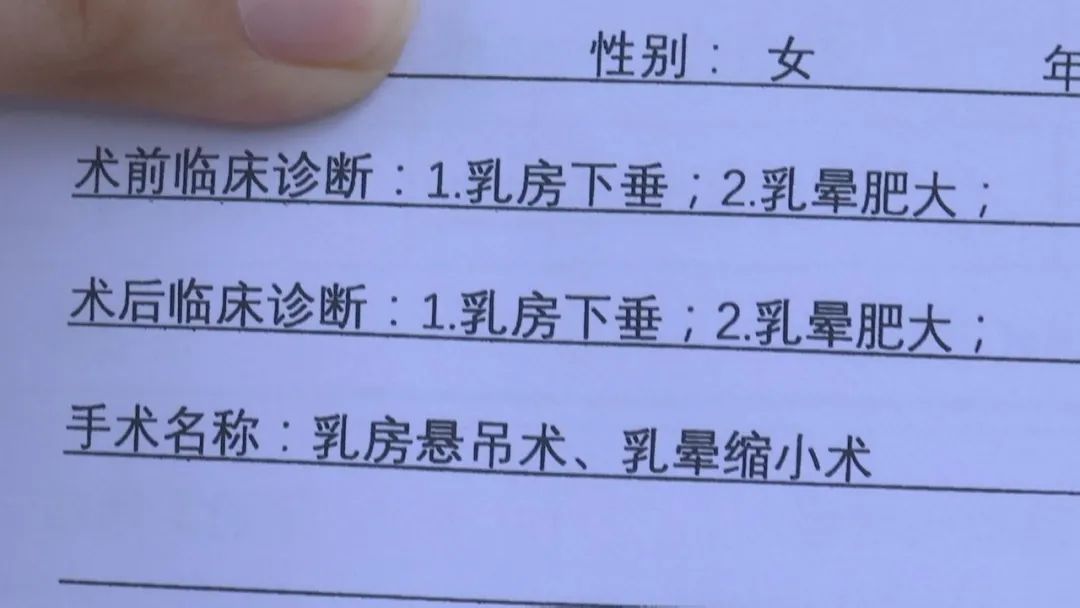 花了5万做整形失败,花7万元整形术后效果却出乎意料