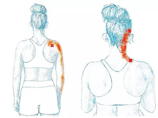 手麻木病症,手部麻木症