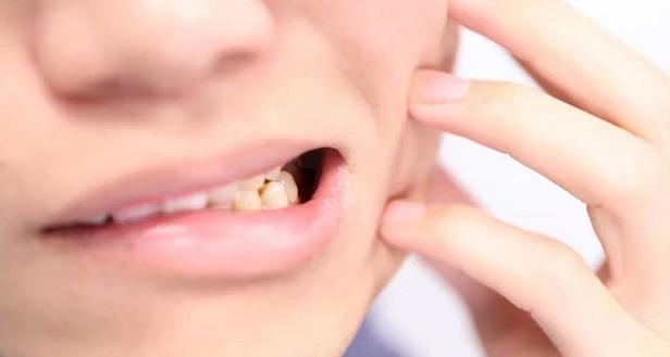 智齿右边发炎可以拔左边的吗,智齿反复发炎要不要拔