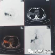 怎么应用统计学做调查,统计学方法可以解决的主要问题