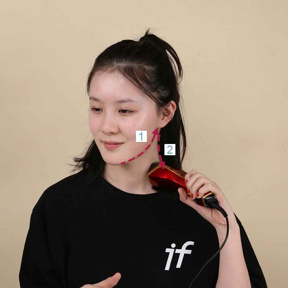 做了微整之后的感悟,微整经验