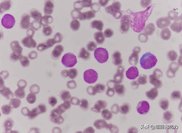 怎样去除老人味的最有效办法,老人味从何而来如何去除老人味