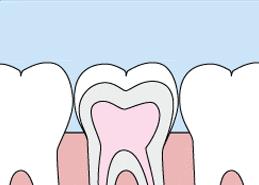 窝沟封闭预防儿童蛀牙的好方法,儿童窝沟封闭预防龋齿有什么危险
