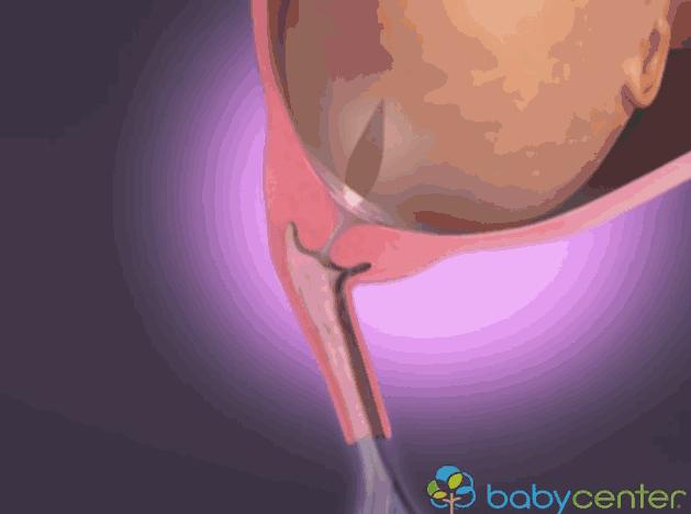 胎儿离开母体可以存活多久,胎儿脱离的瞬间