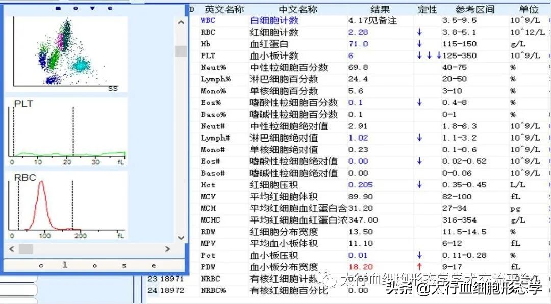 浆质体是什么,浆质体图片