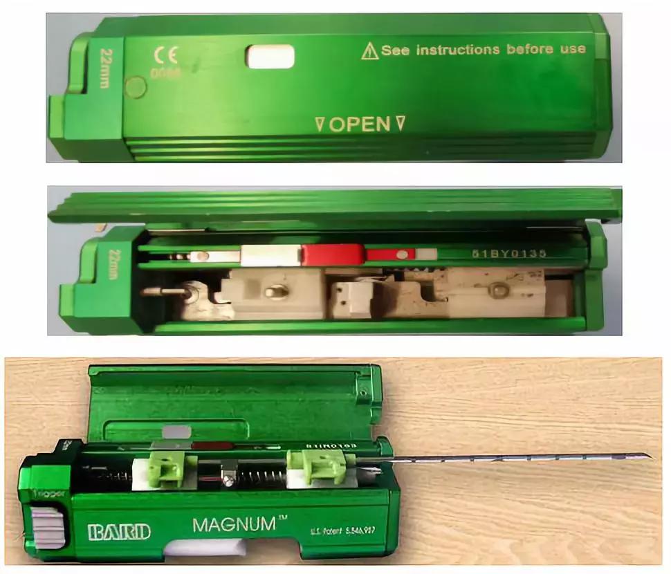 胸部超声引导下穿刺活检术流程,ct引导下肺穿刺活检优缺点
