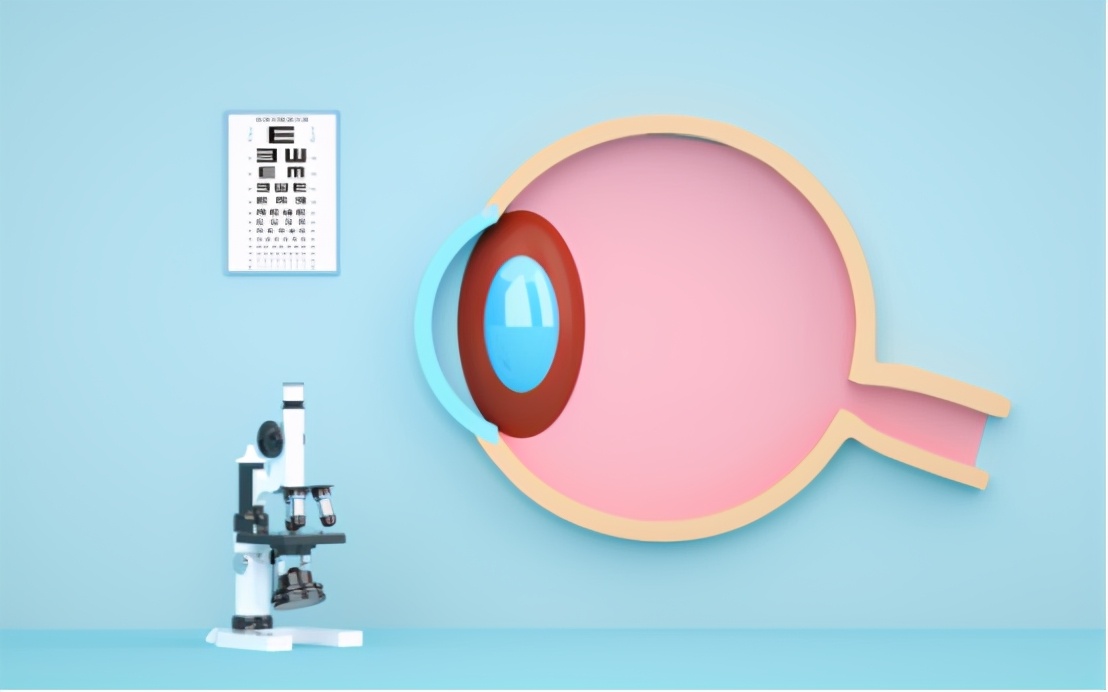 人工晶状体植入睫状沟,植入人工晶状体