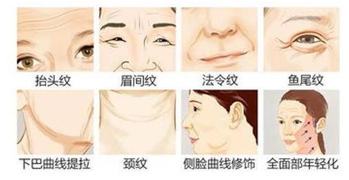 42岁做拉皮还是线雕,做线雕一年后可以做拉皮术吗