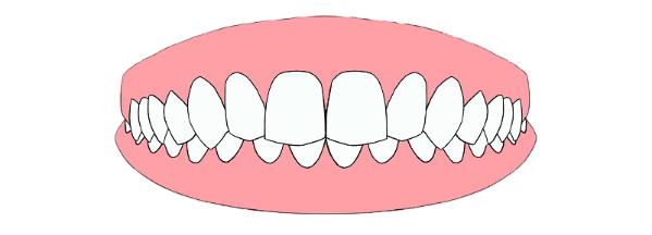 带你了解超详细的牙齿矫正过程,牙齿矫正全过程看完你就知道