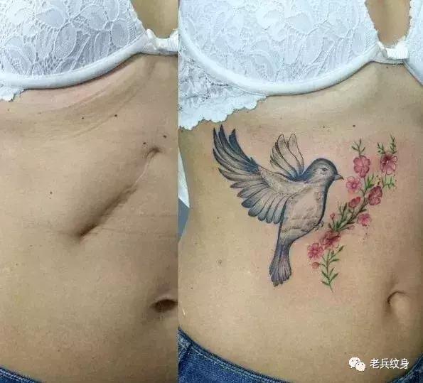 疤痕体质可以用纹身去遮盖疤痕吗,你的疤痕是什么颜色呢