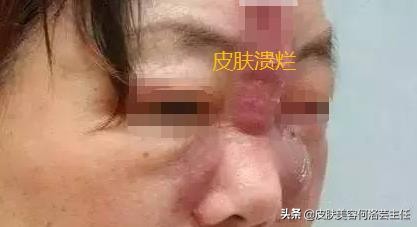 溶脂针一针能瘦身吗,瘦手臂溶脂针多少钱一针会反弹吗