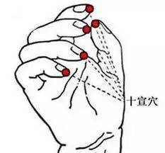 刺血疗法怎样操作,刺血疗法大全看这一篇就够了