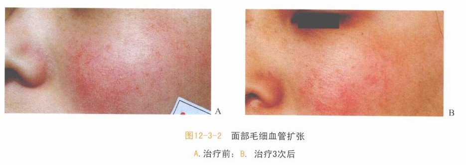 做了它，能让我的皮肤年轻十岁吗？