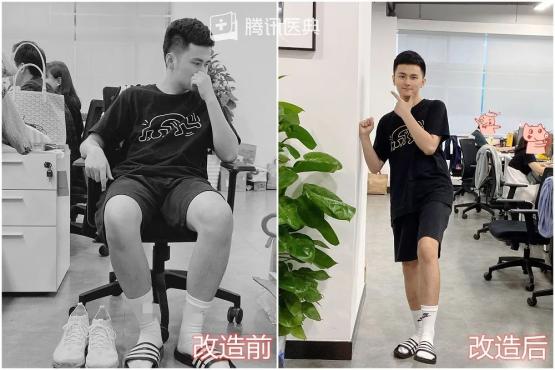 帅气小伙脚臭,25岁男人脚臭