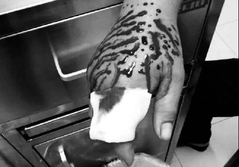 警惕蛇出没已有人被咬,在小区里被毒蛇咬伤小区有责任么