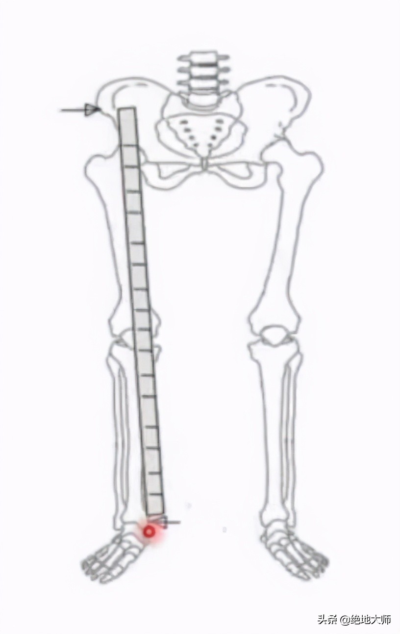 腿长短不一样怎么诊断,腿长短不一怎么调理