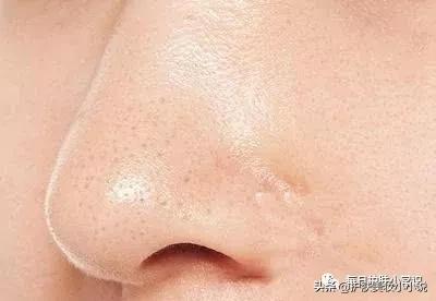 神仙水真的有收缩毛孔的效果吗,毛孔特别粗大用神仙水可以修复吗