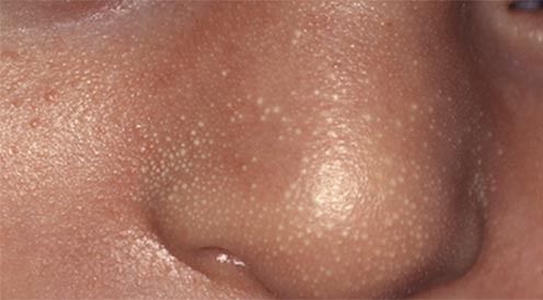 医生科普新生儿,医生必知的100个秘密