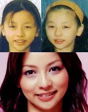 日本整容惊人案例,日本整容是不是最先进