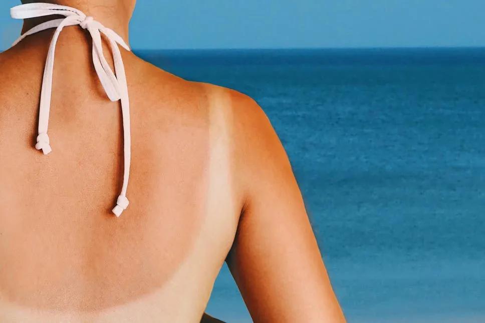 晒黑怎么变白吃什么,晒黑了怎样变白吃什么