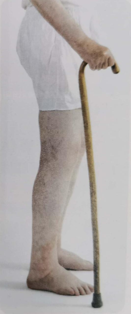 久坐后膝盖窝发软没力了怎么办,久坐膝盖无力站不起来