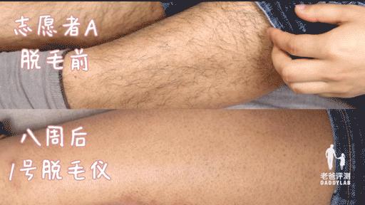 最真实的脱毛仪,bequeen脱毛仪实测