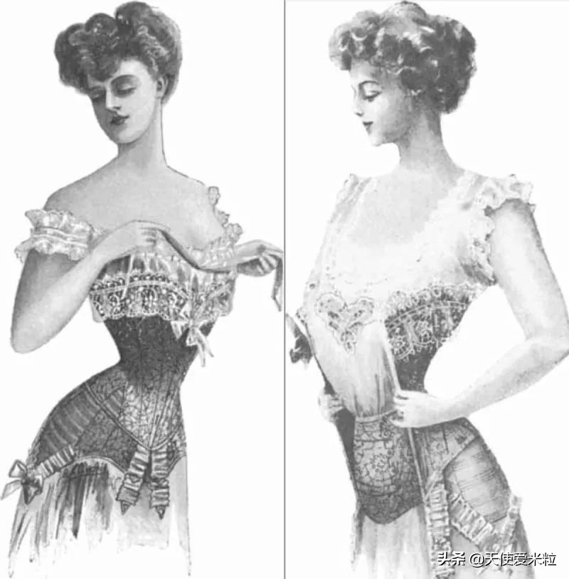 68岁女人做拉皮手术后续,拉皮手术66岁后续