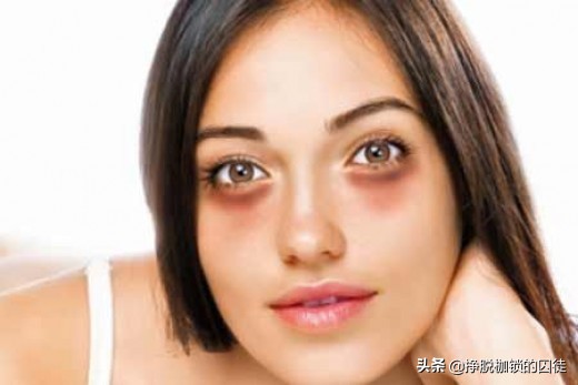 女孩黑眼圈重什么原因造成的,黑眼圈是什么原因造成的啊