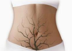 吃什么排毒体内垃圾,女性体内吃什么排毒