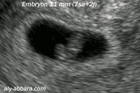 摸一摸就能怀孕？这真的不是都市传说