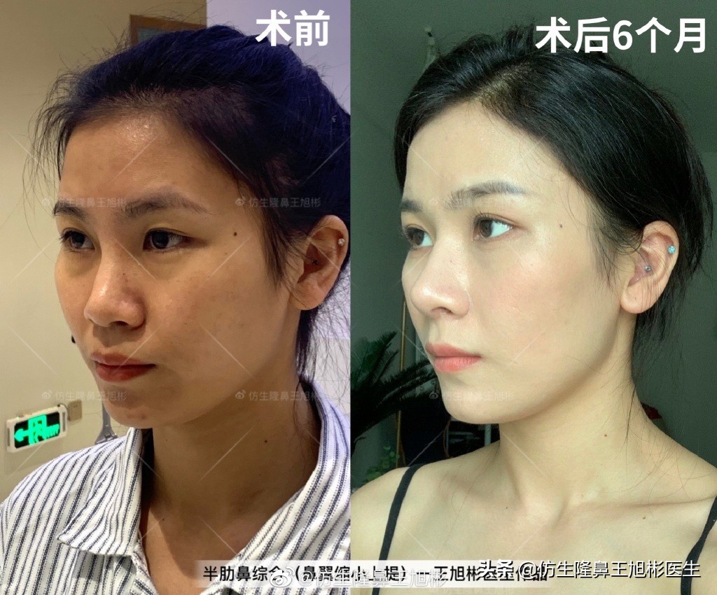 被鼻子封印的颜值,那些被鼻子封印的颜值