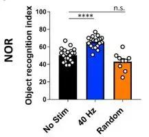 40赫兹预防老年痴呆音乐,新发现有望治疗阿尔茨海默病