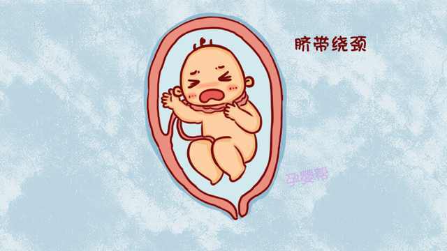 脐带绕颈一周怎么办需要注意什么,脐带绕颈有危险吗怎么处理