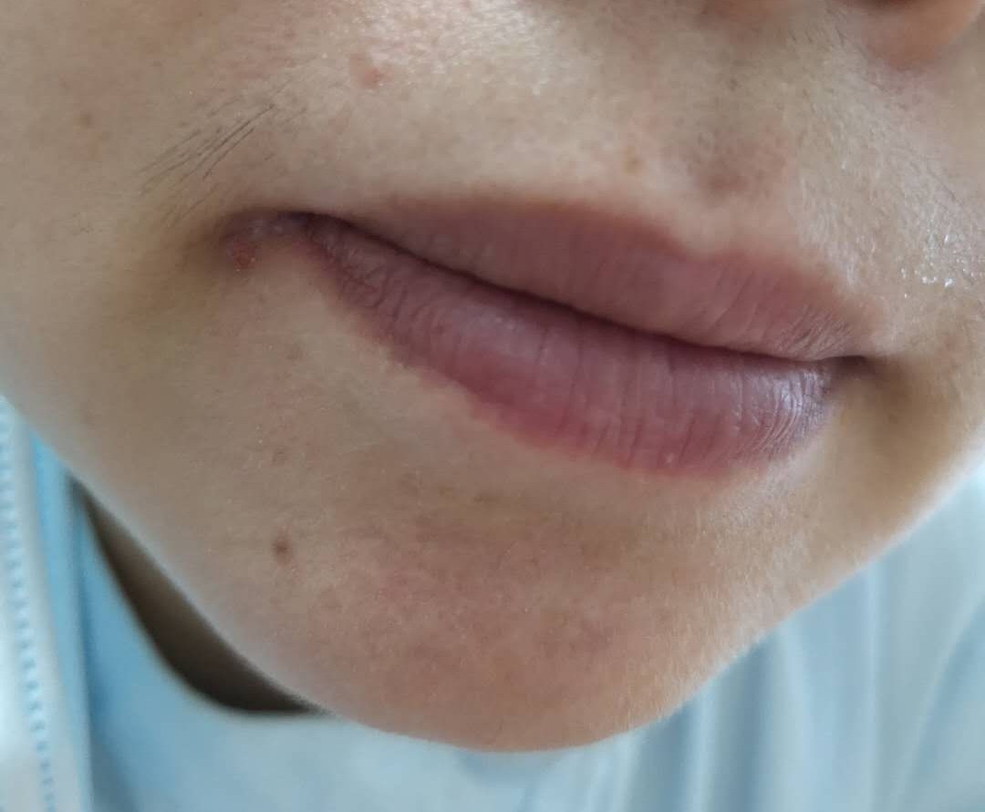 治疗耳石症的五种中成药,有没有治疗耳石症的西药