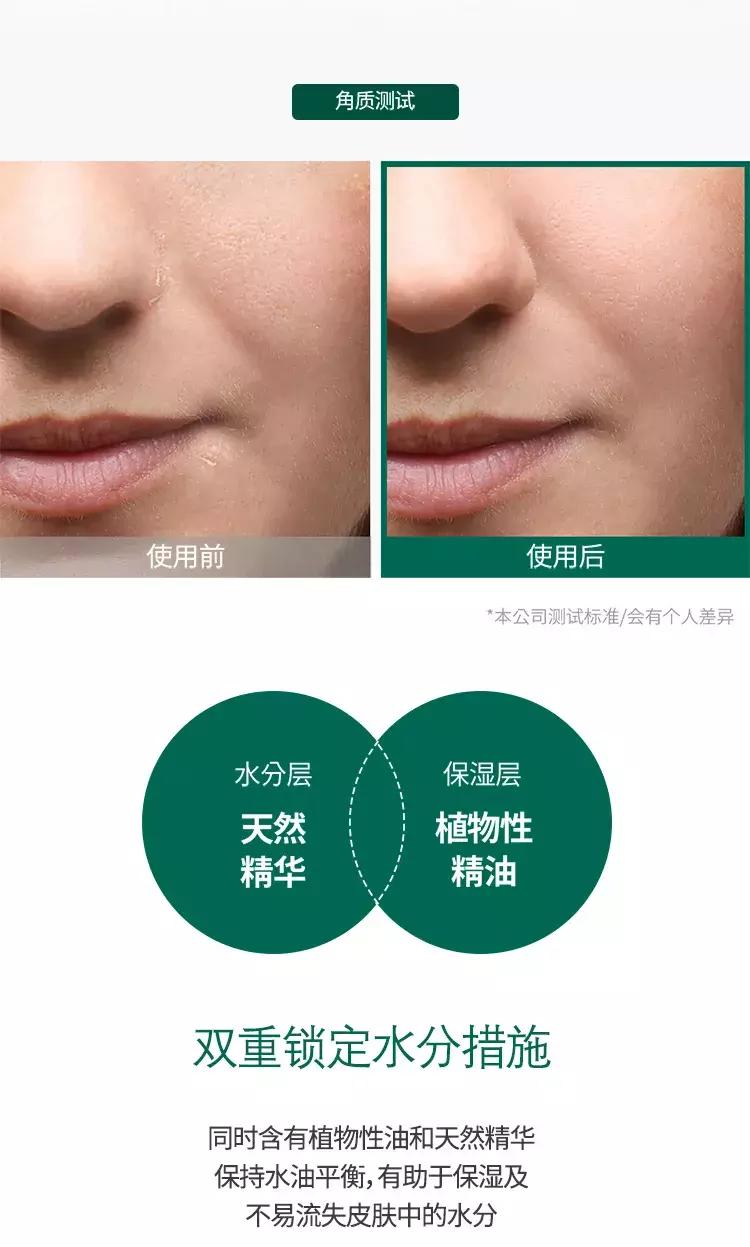 somebymi茶树精华测评,somebymi茶树精华能淡疤吗