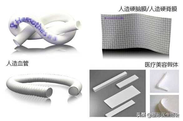 隆下巴硅胶和膨体哪个好,膨体隆下巴和硅胶隆下巴区别