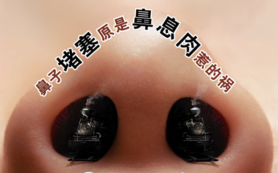 男子鼻塞流清涕,鼻子里长了个疙瘩一直流鼻涕