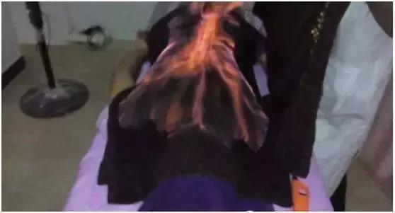 吓skr人！“火烤活人”可以治病？这种火疗很危险，小心玩火*焚自**！