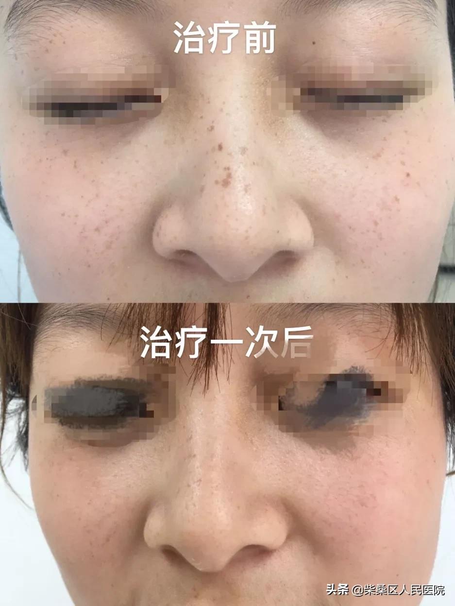 激光医疗美容机构,九江柴桑区专业祛斑祛痘店