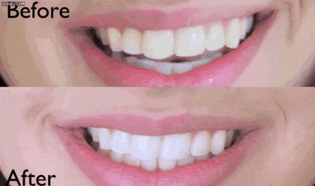 李佳琦巴氏刷牙,李佳琦口嚼式牙膏