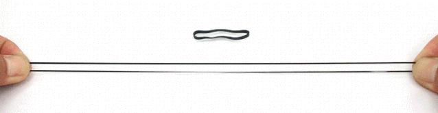 静脉曲张是什么？静脉曲张怎么预防？如何改善静脉曲张？