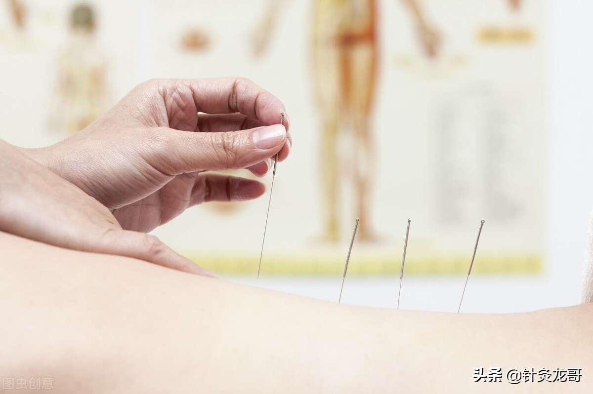 脑出血针灸和康复哪个效果好,脑出血和脑梗塞用啥中药