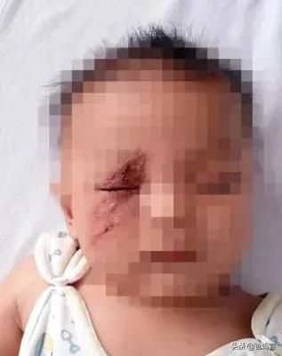 妈妈一拍小孩差点毁容,妈妈拍到孩子的恐怖画面